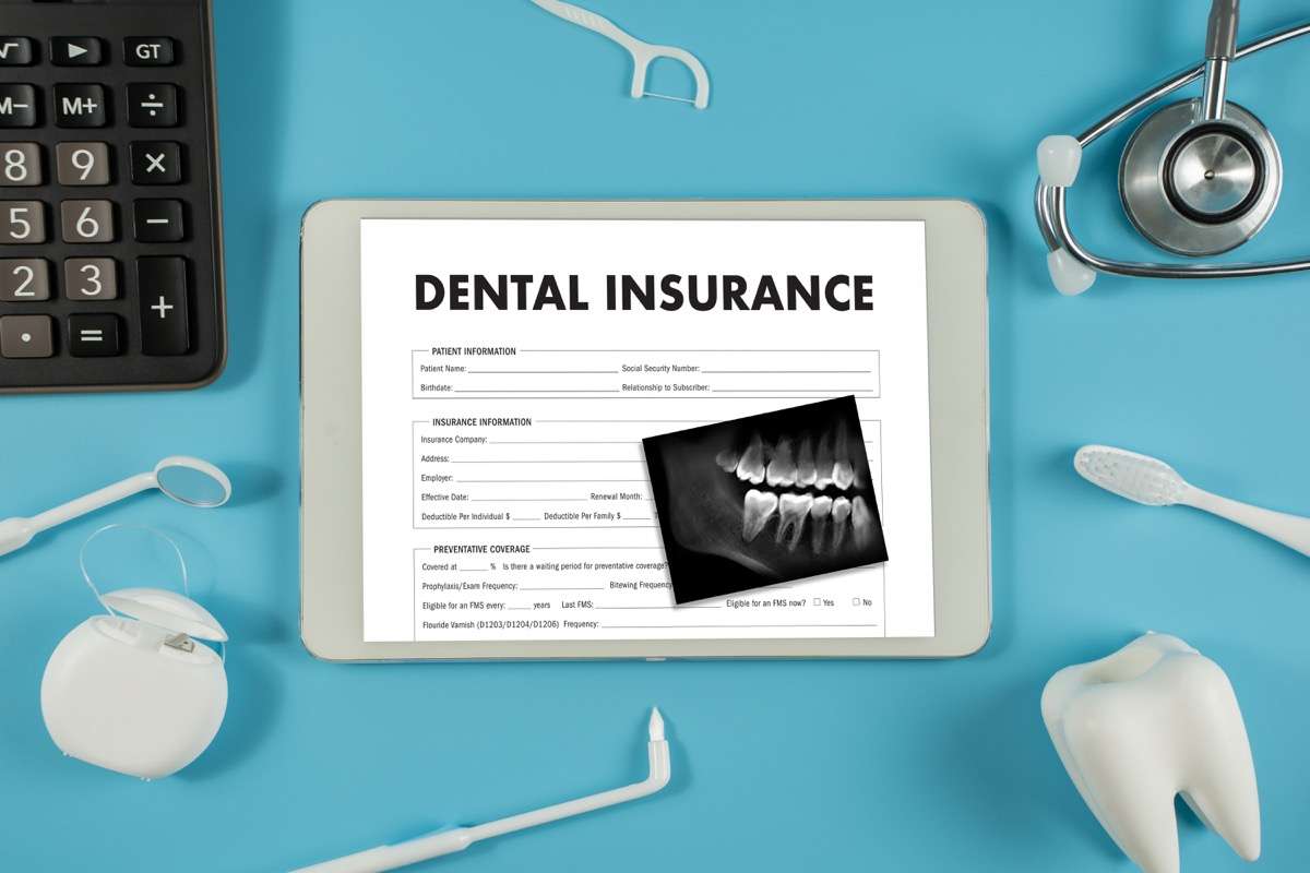 Does Dental Insurance Cover Implants?